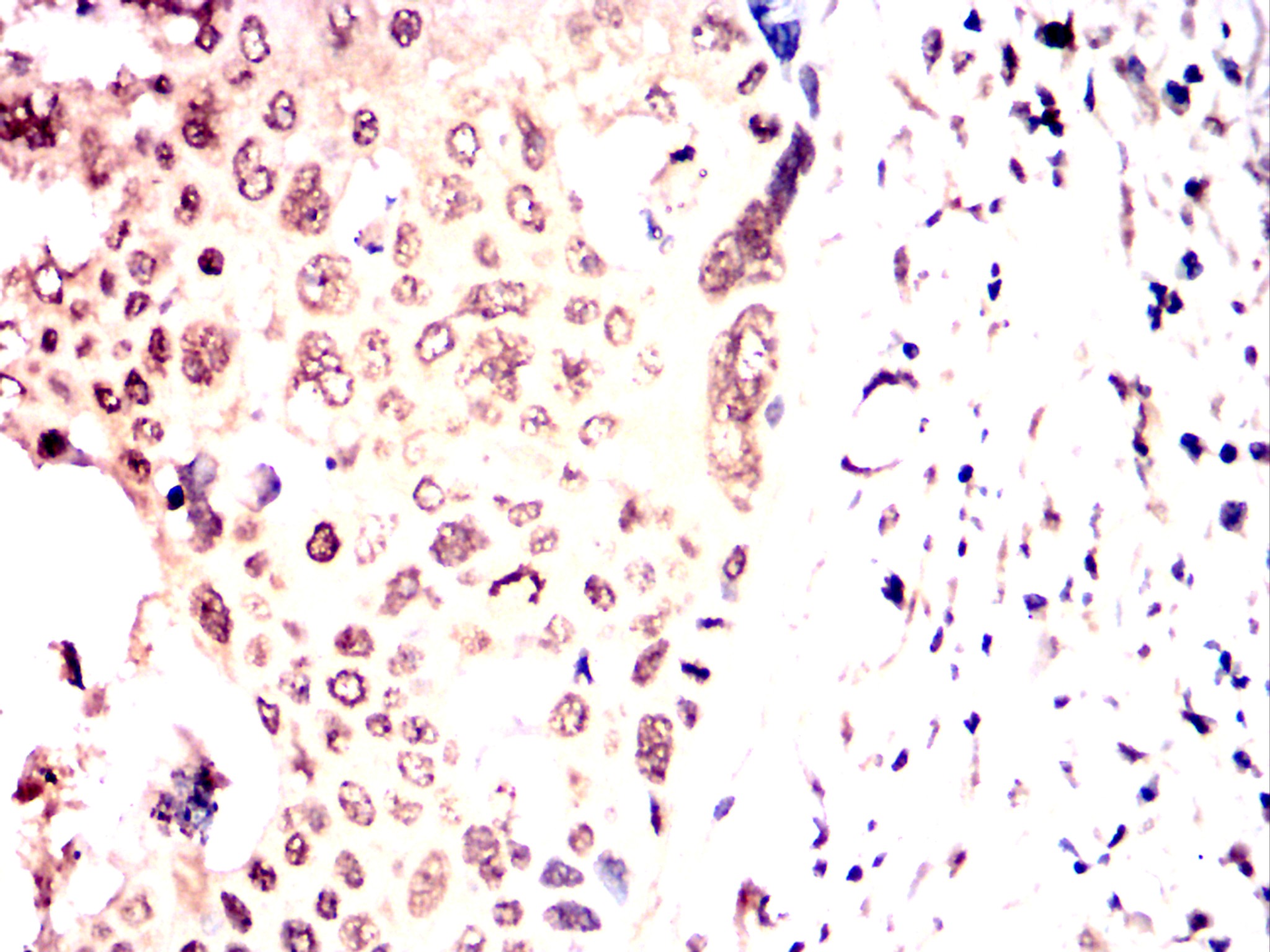 		IHC
